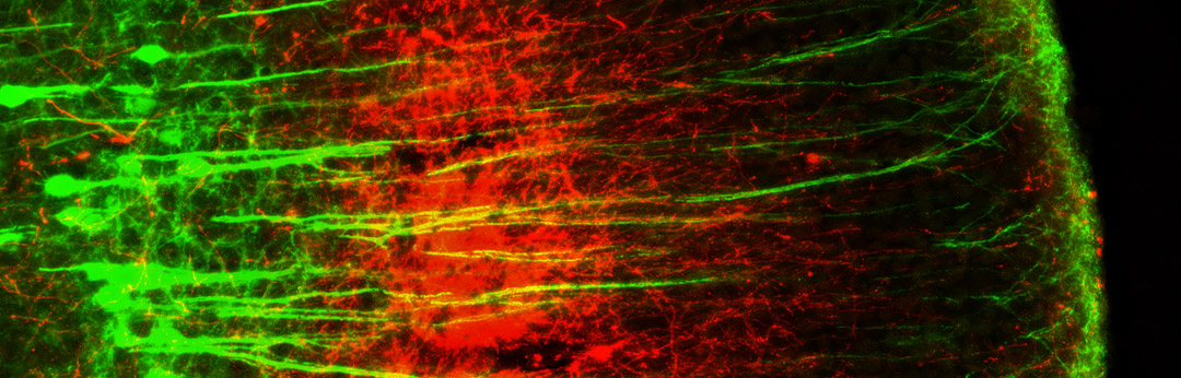 Synapse remodeling